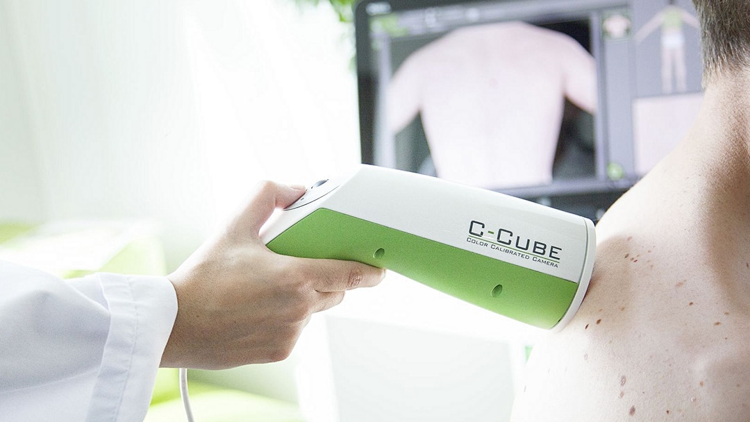 dermatoscope numerique